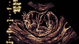 Les silhouettes d'un homme embrassant le ventre d'une femme enceinte.
